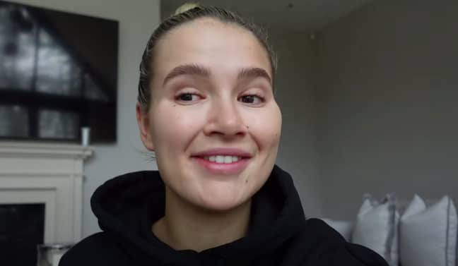 Molly Mae Reveals Natural Teeth For The First Time As She Continues