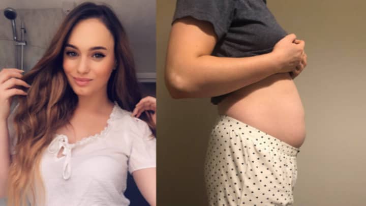 Woman With Endometriosis Says She Is Often Mistaken For Being Pregnant